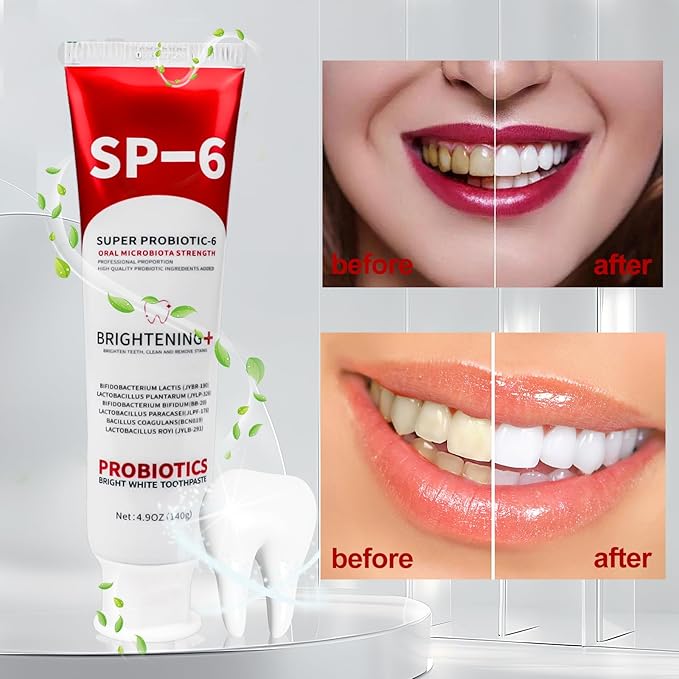 Dentifrice Probiotique SP-6 – Stop Caries, Soulage les Douleurs Dentaires & Blanchit Naturellement