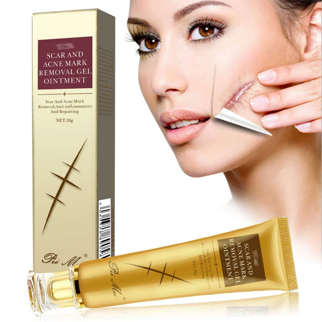 Labéna Crème Anti acné et Cicatrices